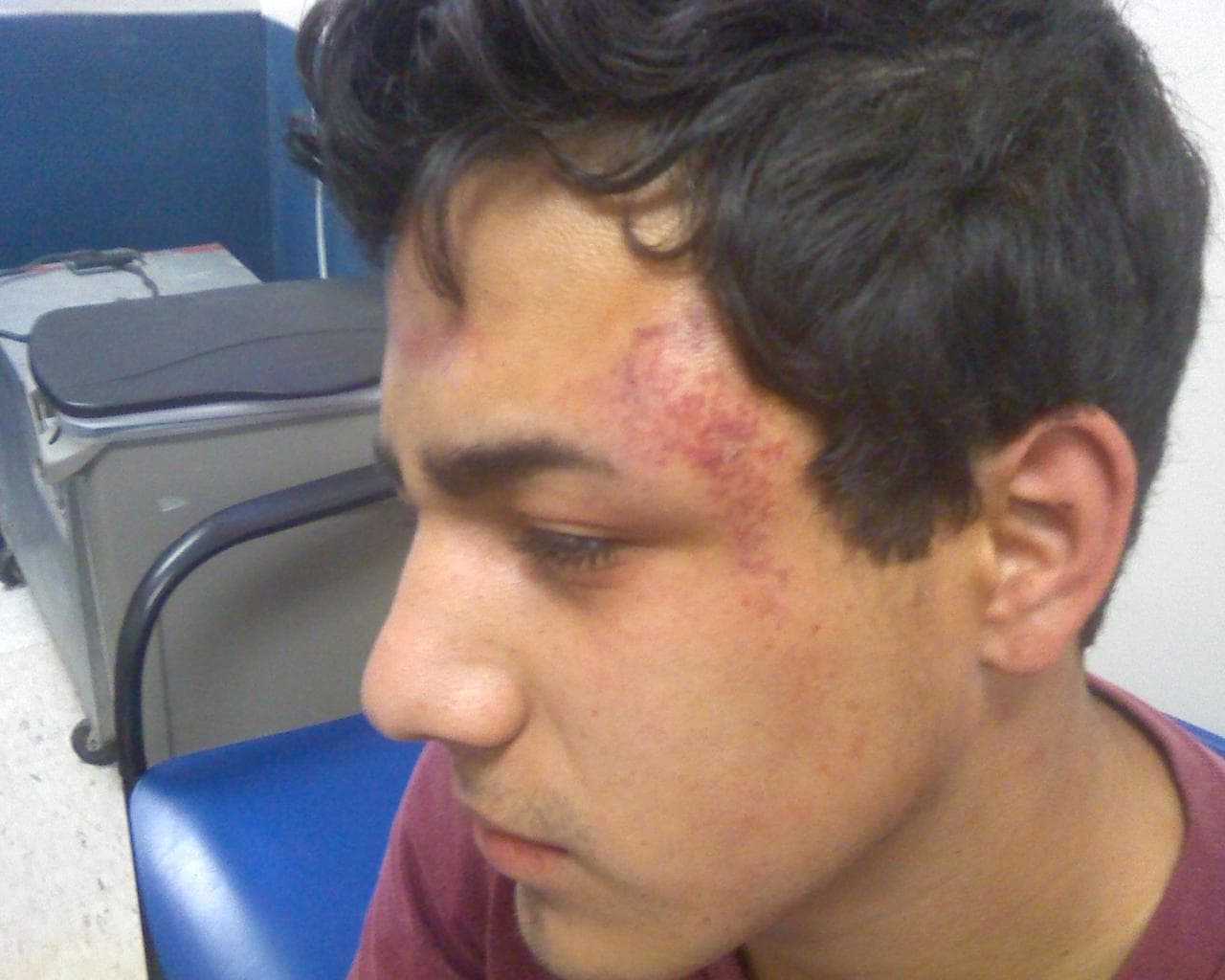 Josue “Josh” Muniz was left with bruises, scrapes and burns from pepper spray after a San Bernardino, Calif. school police officer subdued him following a dispute that started with Josue hugging his girlfriend at lunch.
