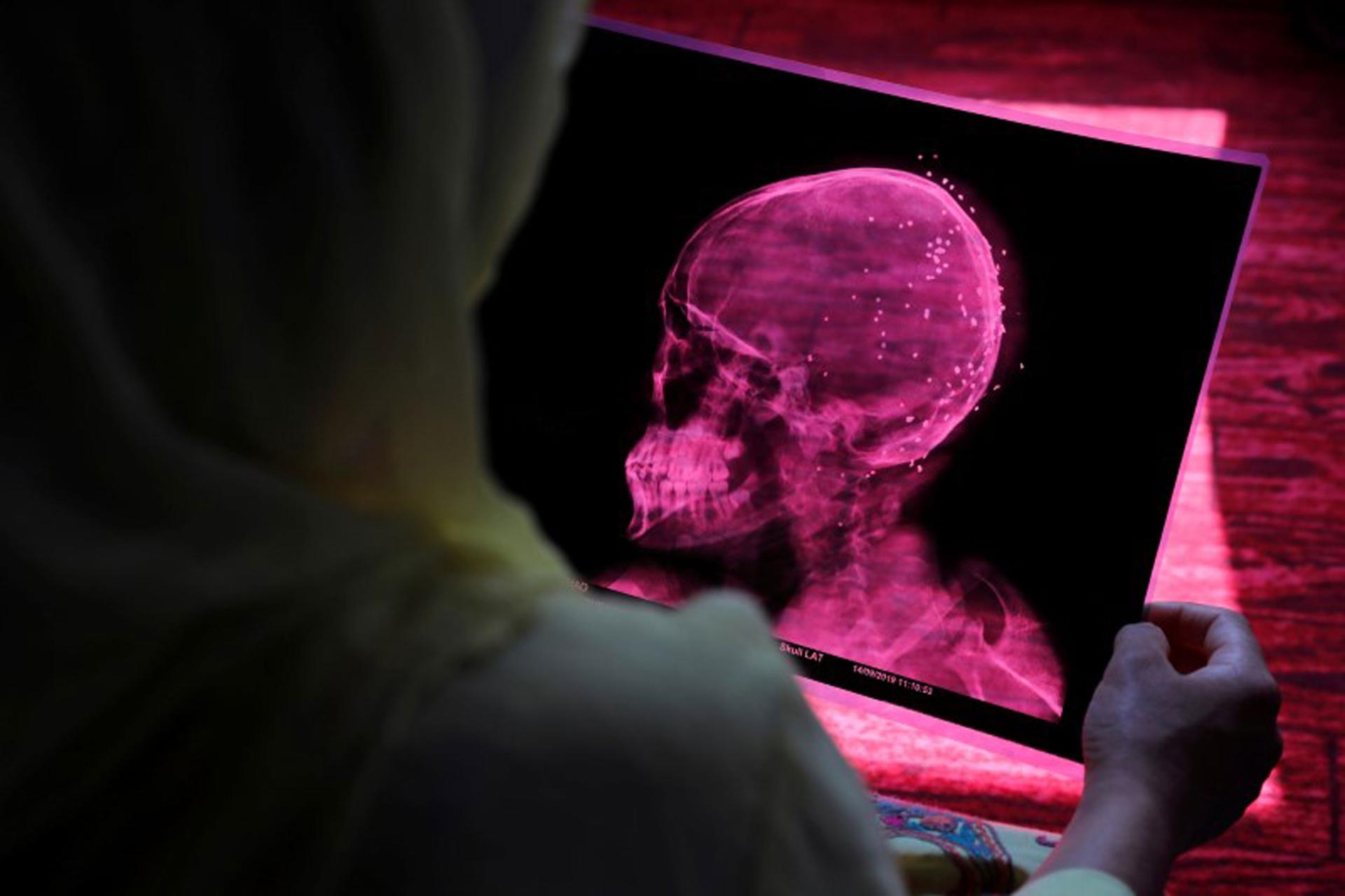 A woman is shown from over her shoulder holding a pink colored X-ray