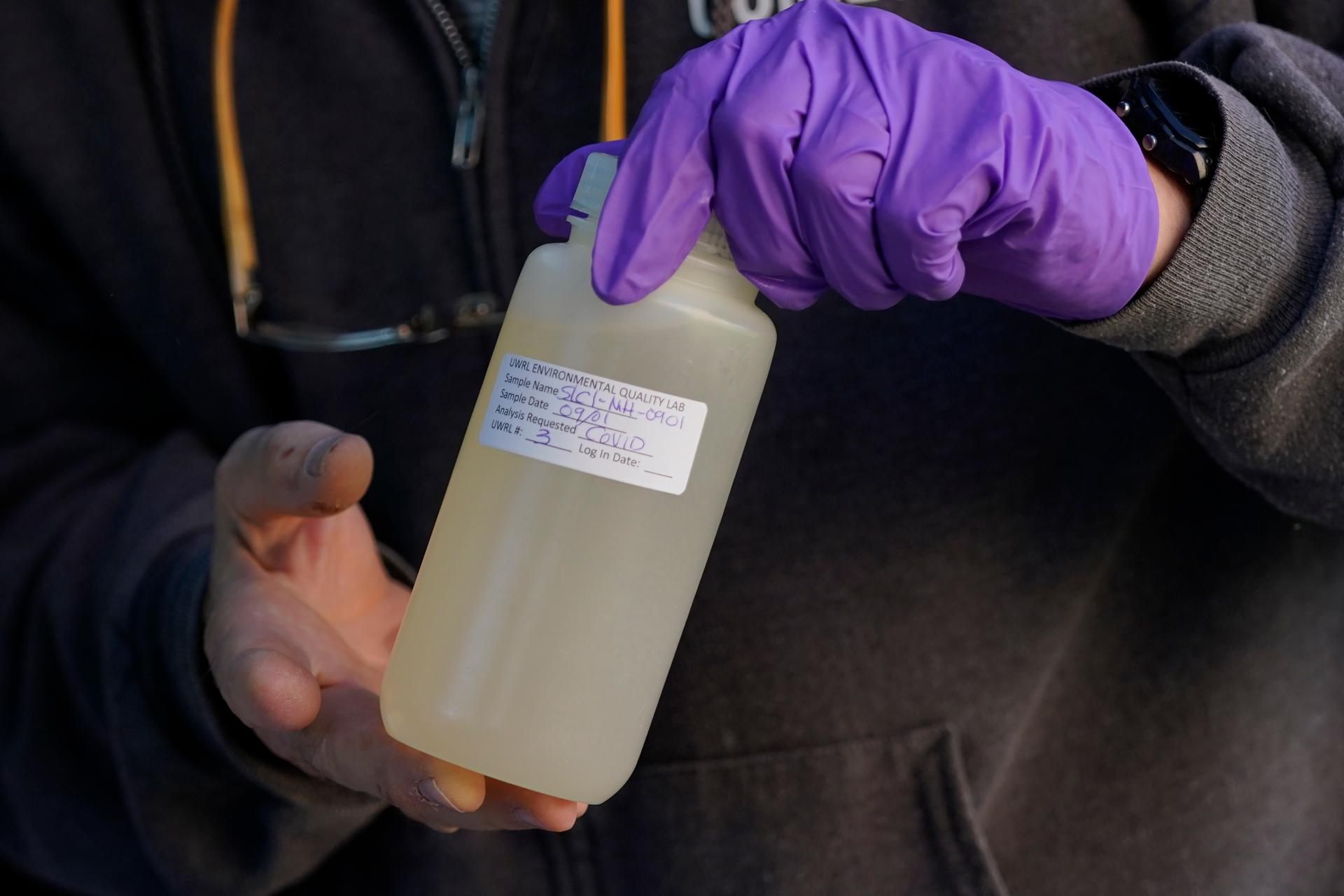 Hands holding a plastic bottle filled with liquid.