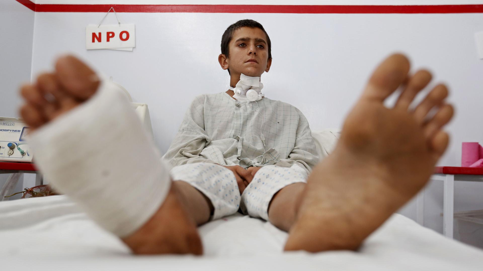 A wounded Afghan boy, who survived the US air strike on the MSF hospital in Kunduz.