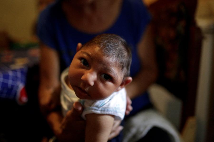 Three-month-old Jesus, photographed on Oct. 5 in Guarenas, Venezuela, was born with microcephaly