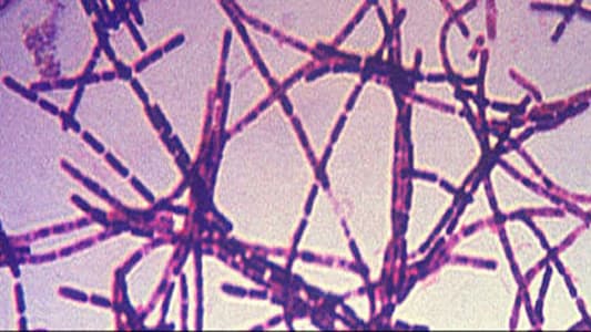 According to the CDC, anthrax is a serious disease caused by a rod-shaped bacteria known as Bacillus anthracis. Anthrax can be found naturally in soil and commonly affects domestic and wild animals around the world.