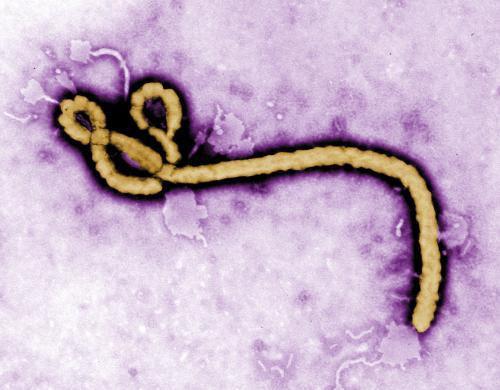 Some of the ultrastructural morphology displayed by an Ebola virus virion is revealed in this undated handout colorized transmission electron micrograph.
