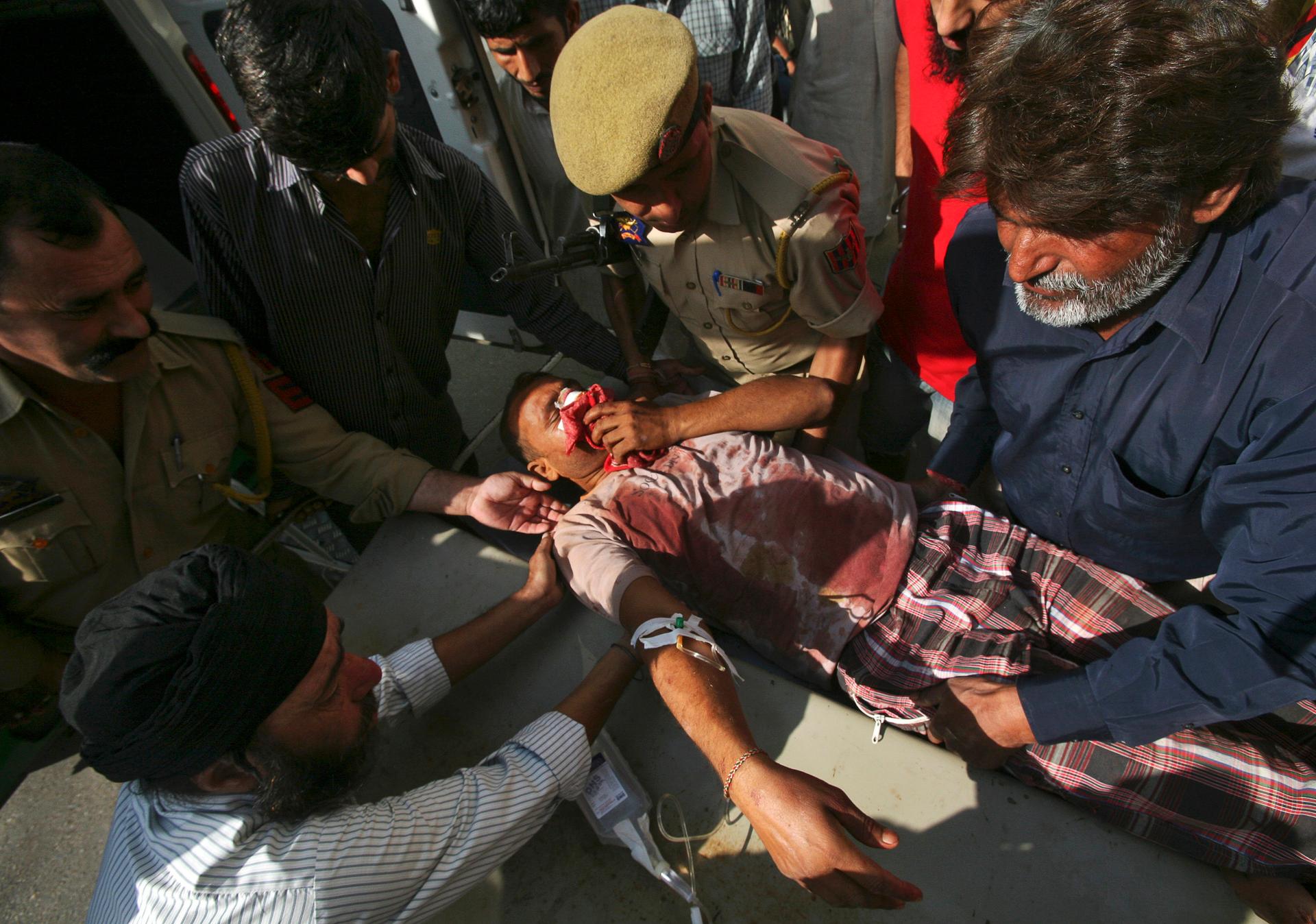 Wounded man in India