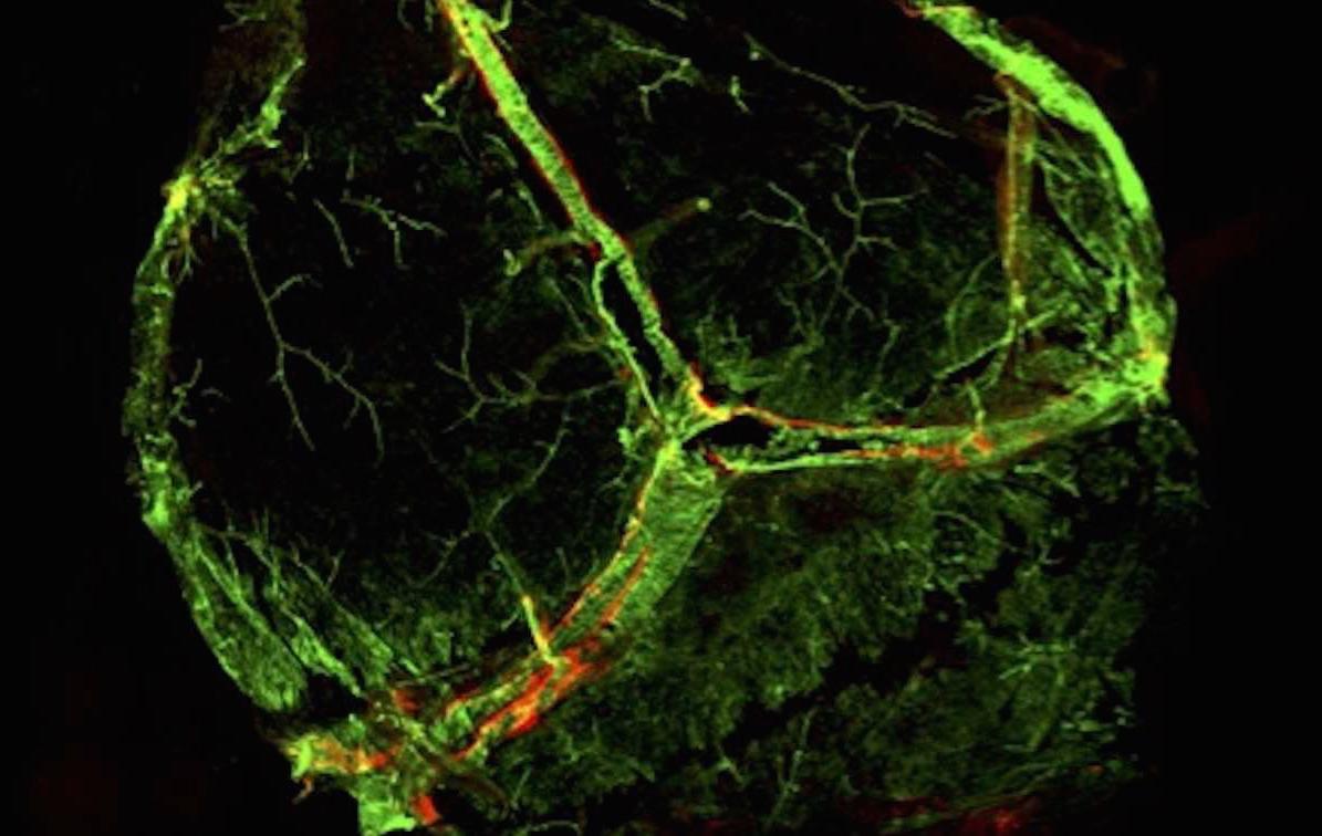 New lymphatic vessels