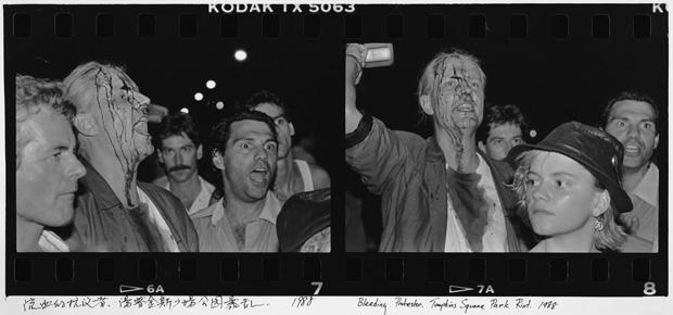 Bleeding Protestor, Tompkins Square Park Riot, 1988