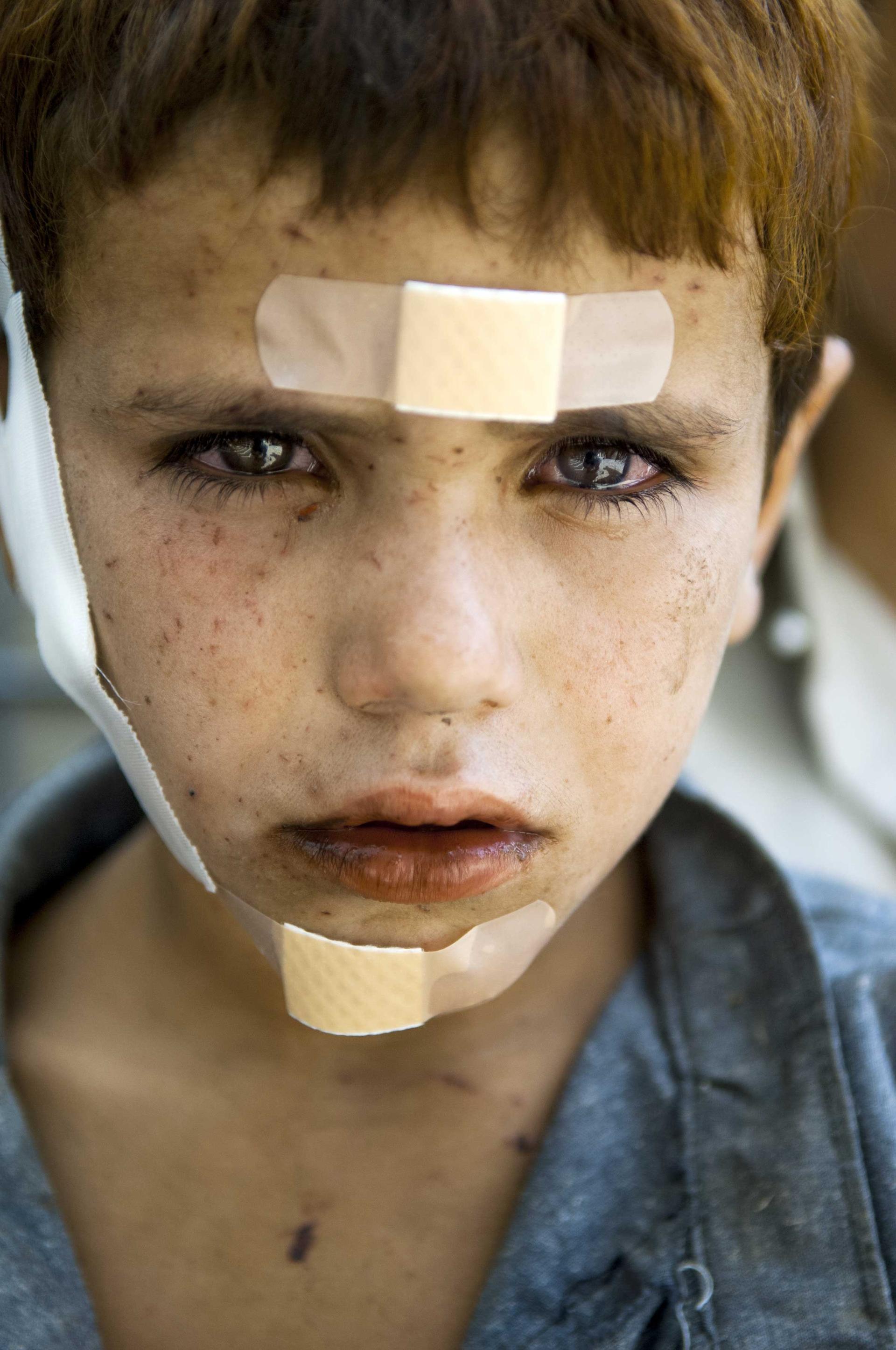 Bandaged boy: September 2007, Afghanistan