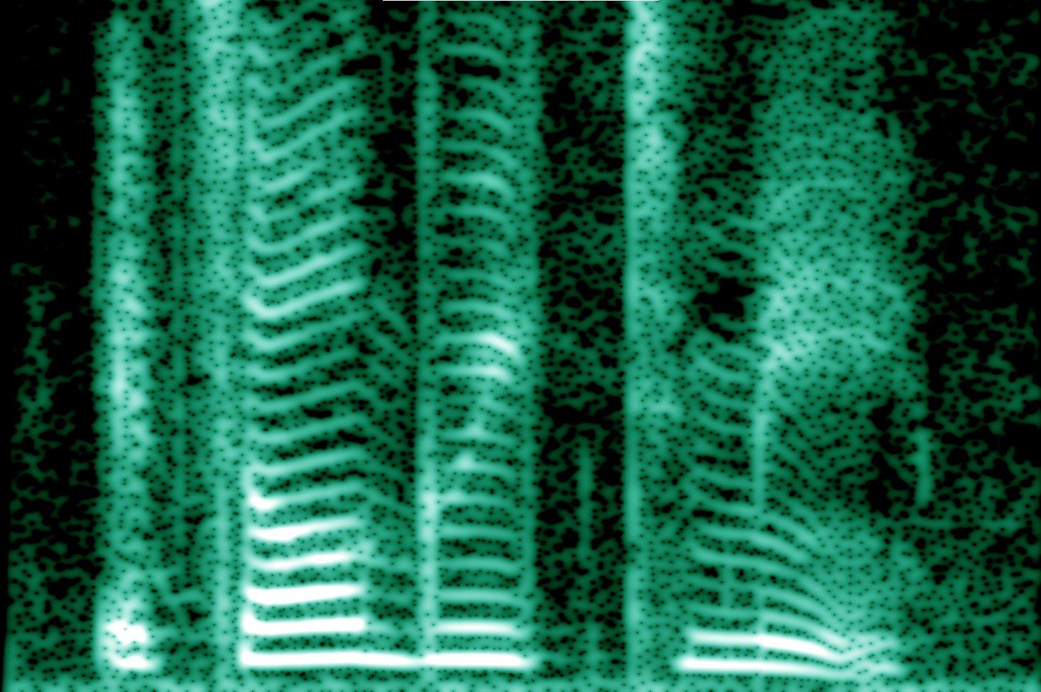 Human voice spectrogram