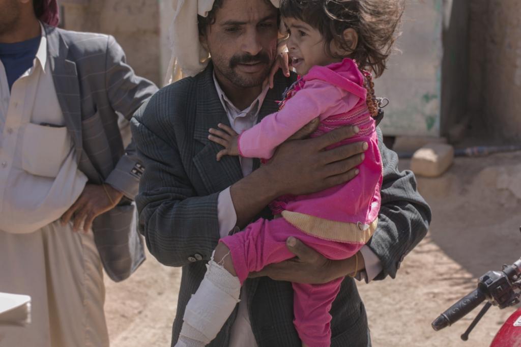 Hasna Al-Hanash, 3, and her Father. Hasna was injured alongside her grandmother when unexploded cluster munitions fell all around them.