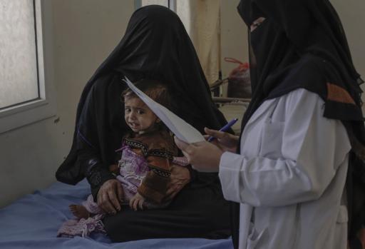 Radwan Saleh, 16 months, awaits treatment with his mother at the malnutrition center in Gomhouri hospital in Sadaa.