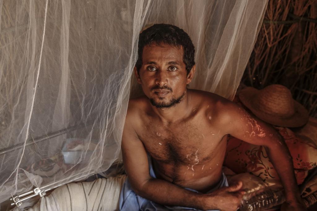 Ali al-Baghawi worked as a fisherman for 21 years. He was injured in an aerial attack at sea that killed dozens of his friends and colleagues. Though fishing was his livelihood he now says he will never return to the water.