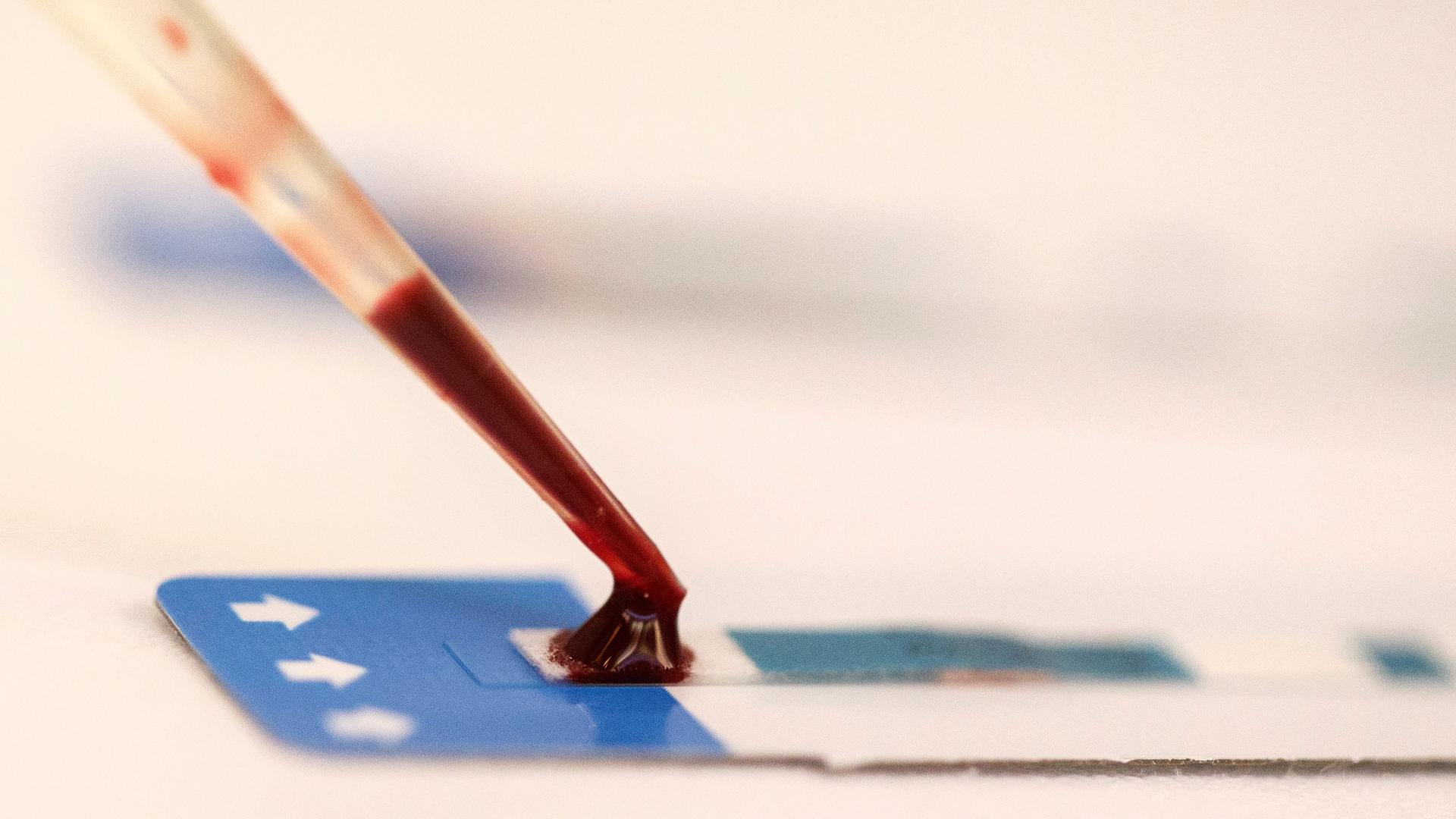 a drop of blood being placed onto a slide 