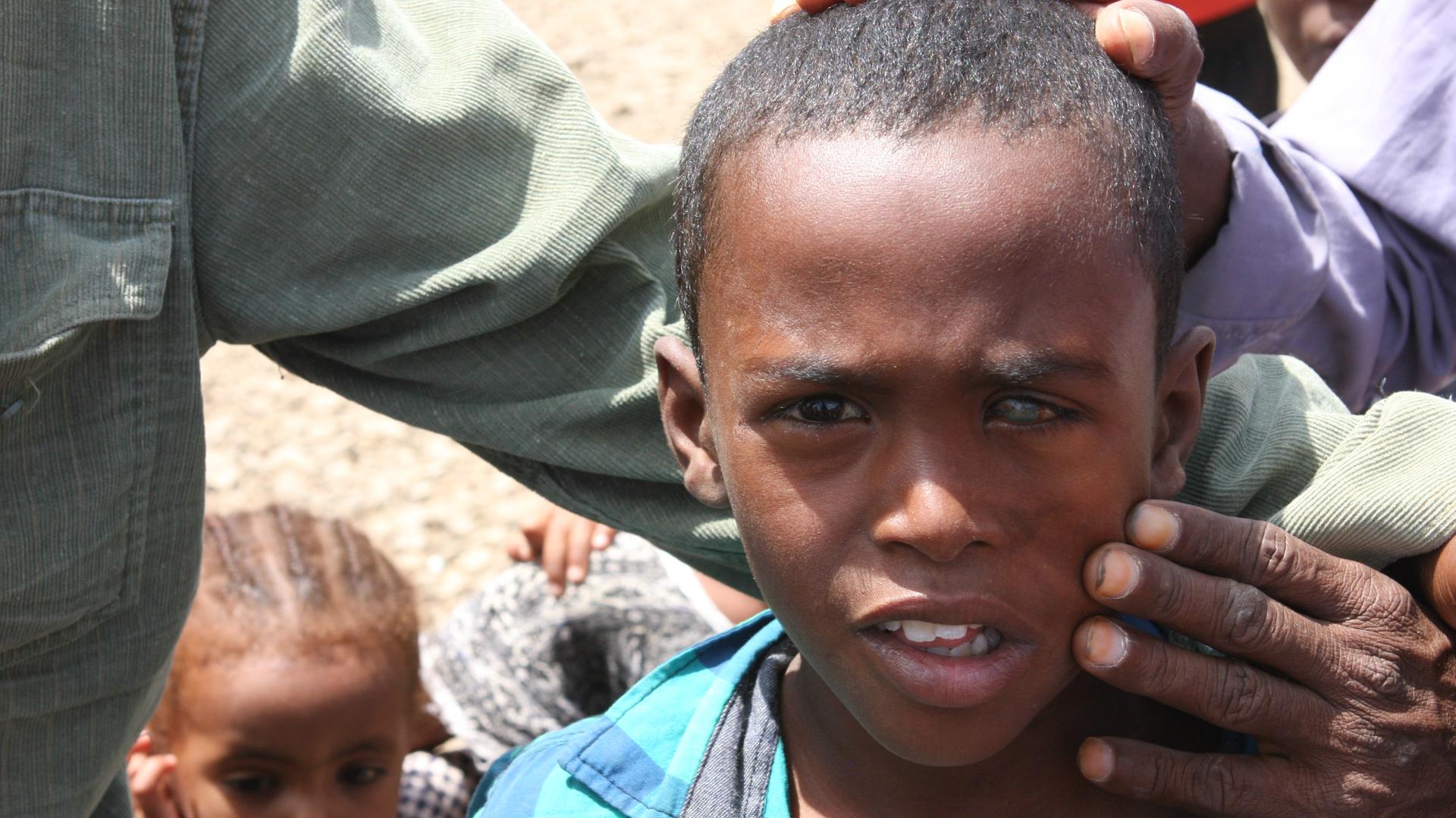 At a camp for displaced Ethiopians outside Dire Dawa, it's claimed that this Somali boy lost the sight in his left eye after Oromo police threw a rock that hit him in the face. Ethiopia is experiencing one of its worst population displacements due to viol