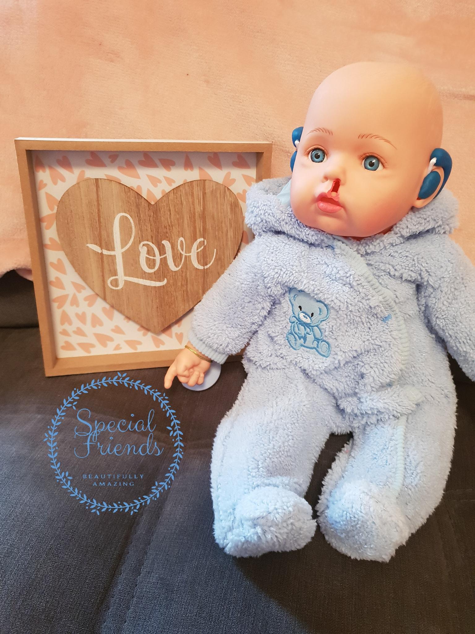 A Special Friends doll with a cleft lip and hearing aids.