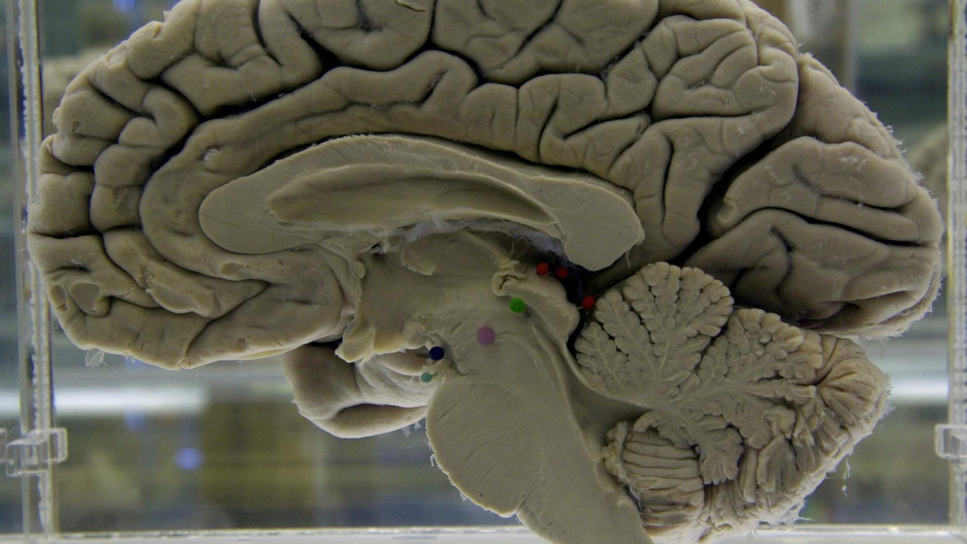 Side view of a cross section of a human brain in glass