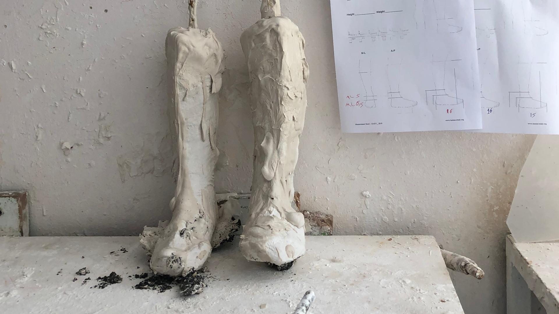 Temporary cast of Jad's legs at the workshop at the NSPPL center in Reyhanli, Turkey. Specialists will use these to make the permanent braces that will help Jad walk.