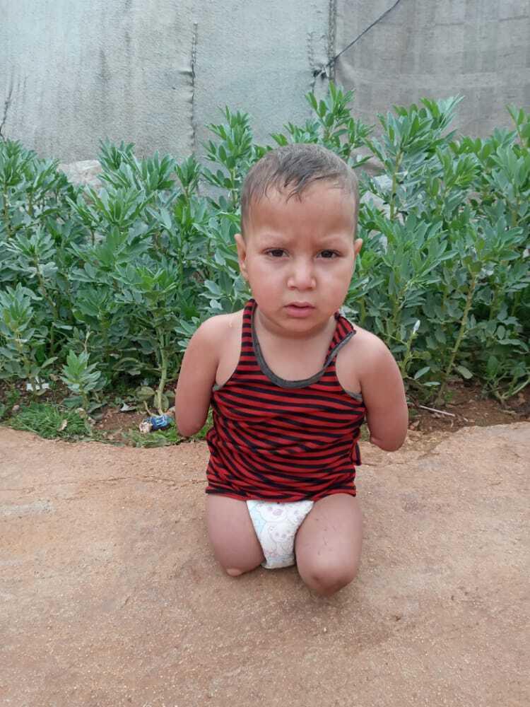 Four-year-old Assef al-Ablo, whose parents lived in the Khan Sheikhoun area in Syria, where the 2017 chemical attack took place, was born without limbs.