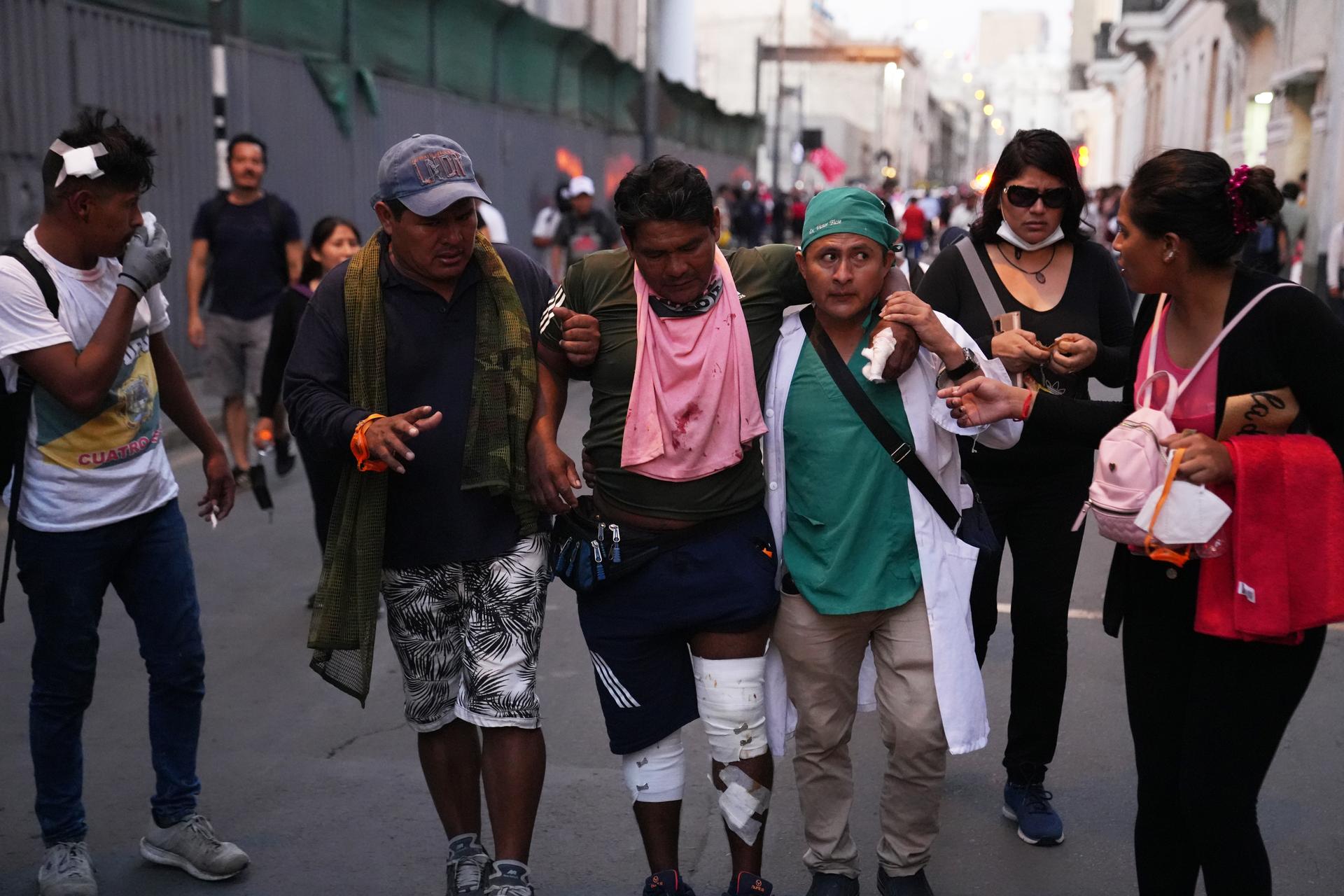 A protester is evacuated by paramedics in Lima, after he was shot in the legs with rubber pellets
