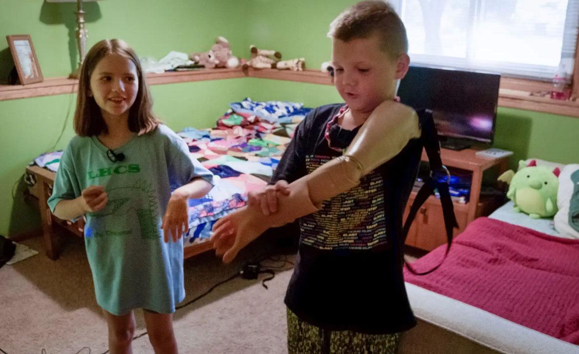 Artem shows how he wears his prosthetic arm at home in Maple Grove as his best friend Veronika 