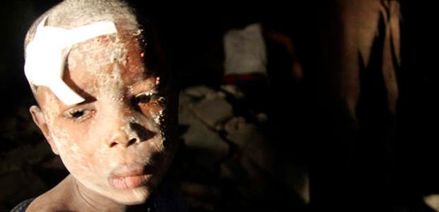 A boy waits for medical attention in Port-au-Prince, Haiti, after 2010 earthquake.
