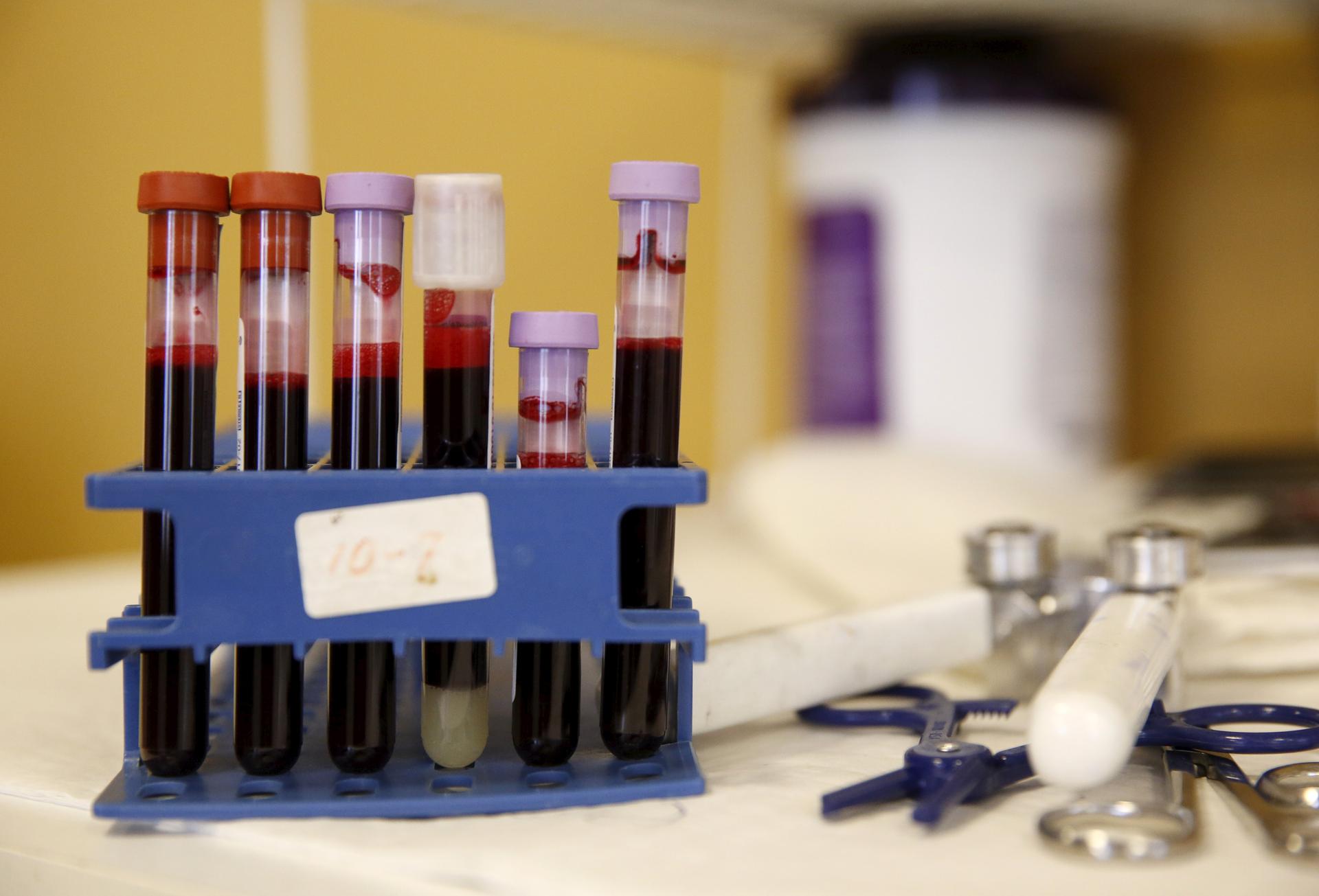 Testing tubes full of blood are seen at the American Red Cross Charles Drew Donation Center in Washington on Feb. 16.