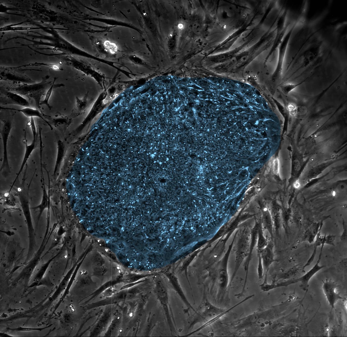 A colony of human embryonic stem cells (center, blue) from the lab of the University of Wisconsin-Madison’s James Thomson. These cells, which arise at the earliest stages of development, are blank-slate cells capable of differentiating into any of the 220