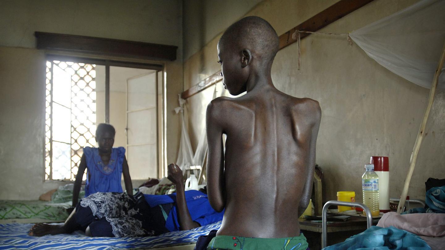A patient sits in the isolation ward of the general hospital in Arua, Uganda, December 2005. Most patients in this ward are suffering from opportunistic infections and diseases related to HIV and AIDS.