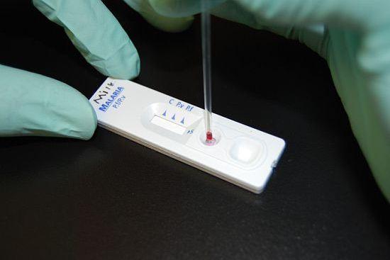 A rapid diagnostic test for malaria.