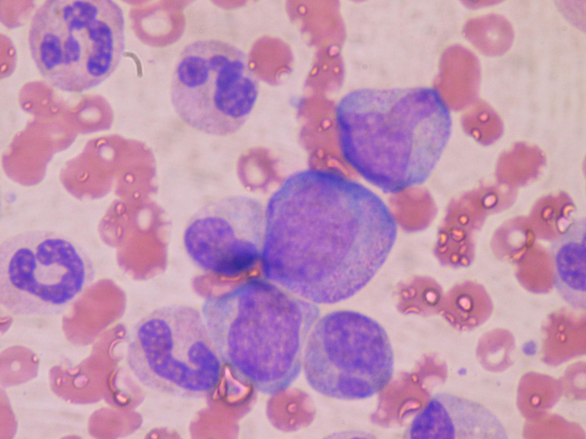 Hematopoietic blood cells