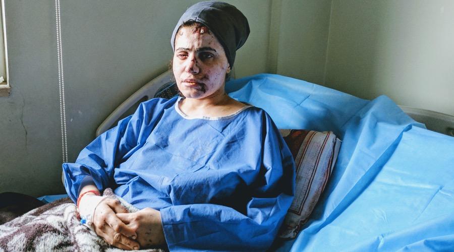 Lina Shahab is recovering in a hospital in Erbil, northern Iraq, after surviving an airstrike in Mosul.