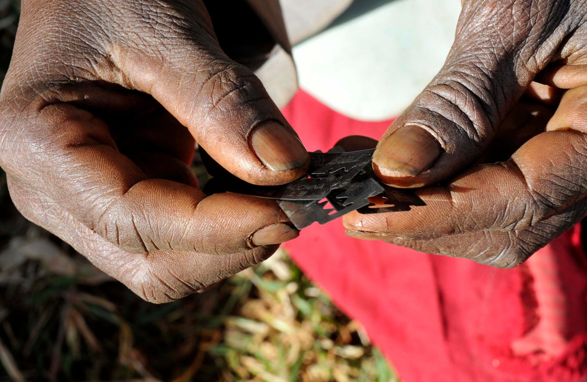 Prisca Korein, a 62-year-old traditional surgeon, holds razor blades before carrying out female genital mutilation on teenage girls from the Sebei tribe in Bukwa district, about 357 kms (214 miles) northeast of Kampala, December 15, 2008.