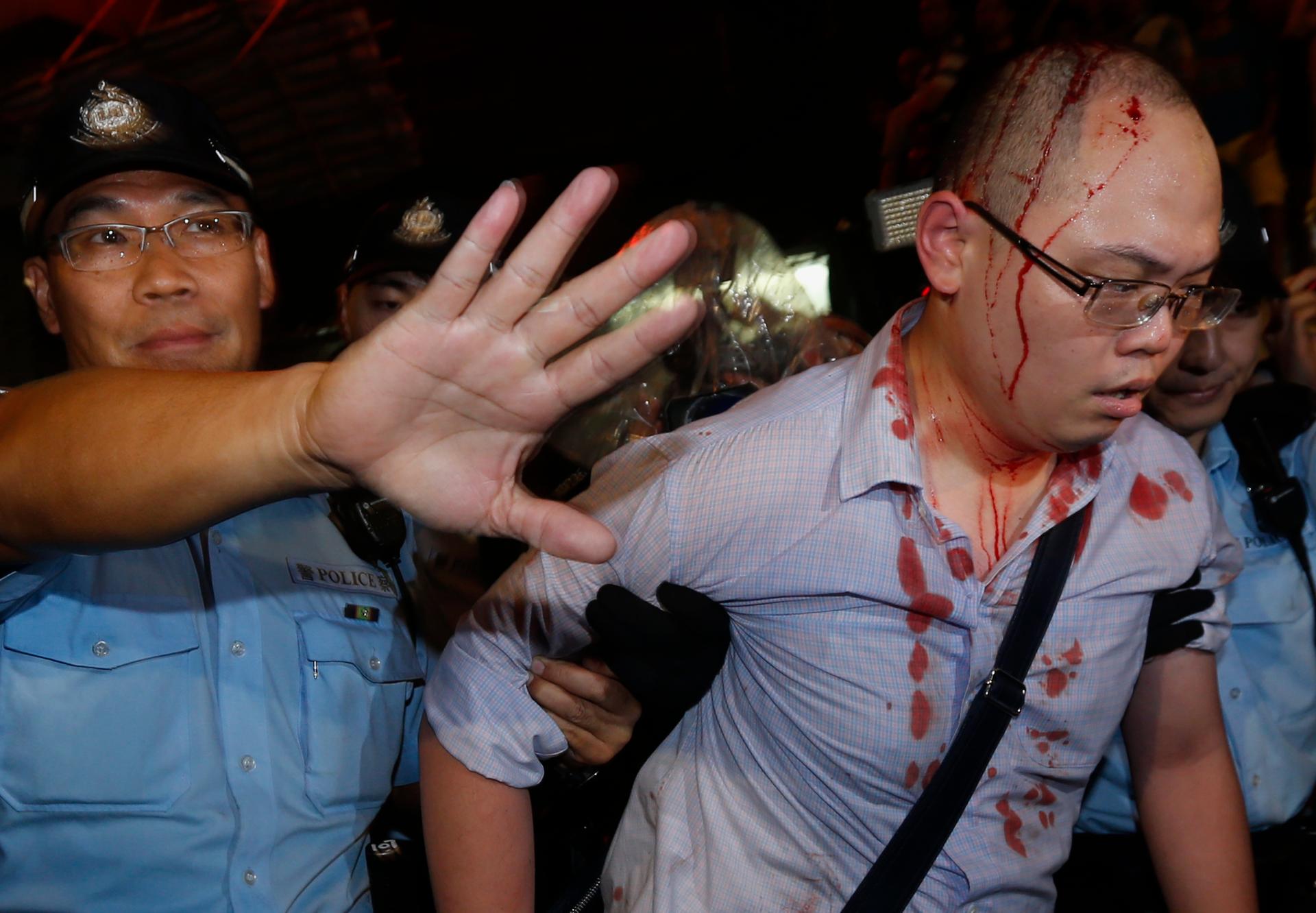 A policeman helps an injured pro-democracy protester to leave after he was beaten by a group of anti-Occupy Central protesters at Hong Kong's Mongkok district October 3, 2014