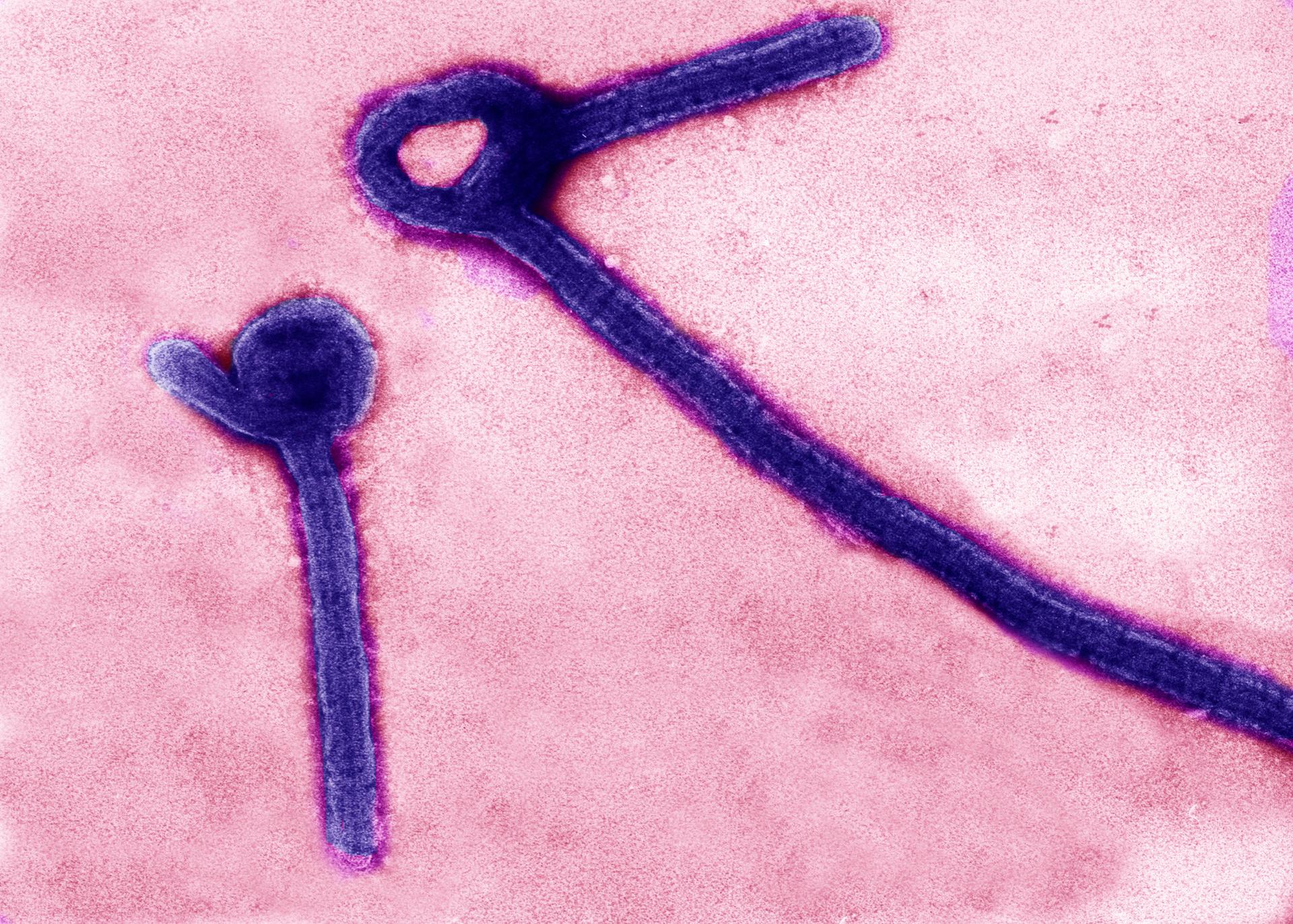  The Ebola virus might remain present in body fluids including semen longer than previously thought. 