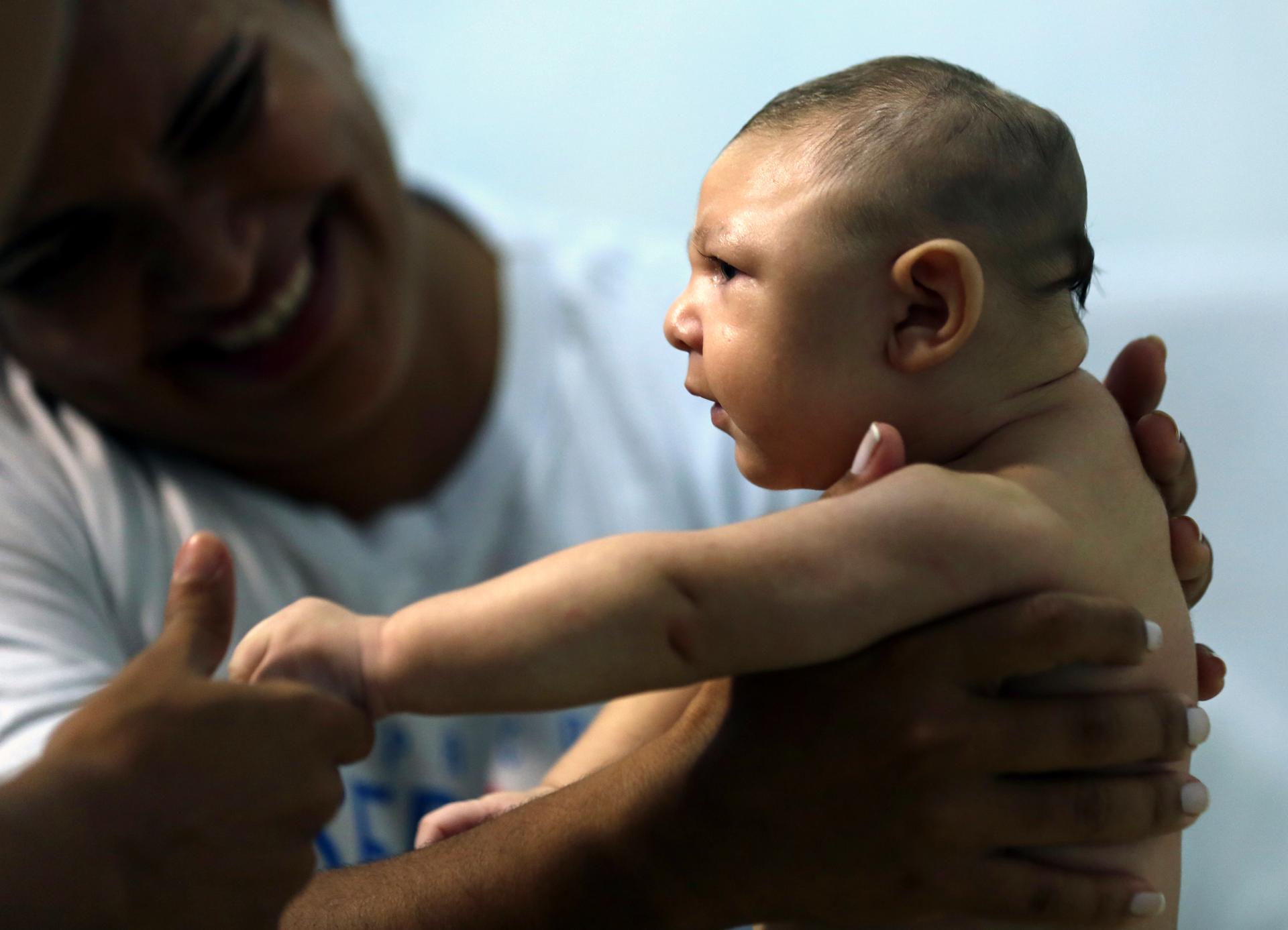 Therapist Rozely Fontoura holds Juan Pedro, a baby with microcephaly, in Recife, Brazil on March 26.