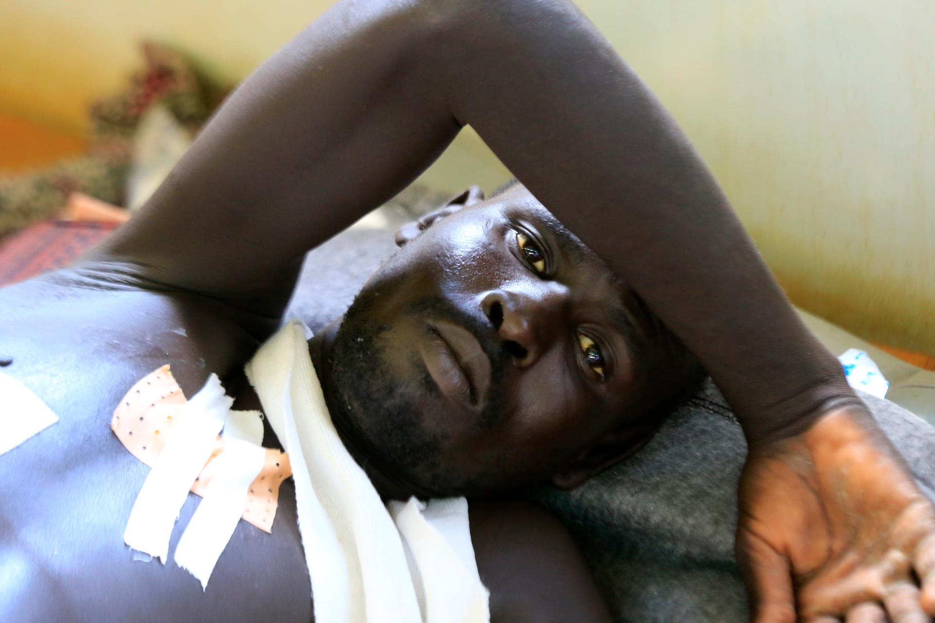 A displaced man at the UN 's Tomping camp, where some 15,000 displaced South Sudanese are sheltered.