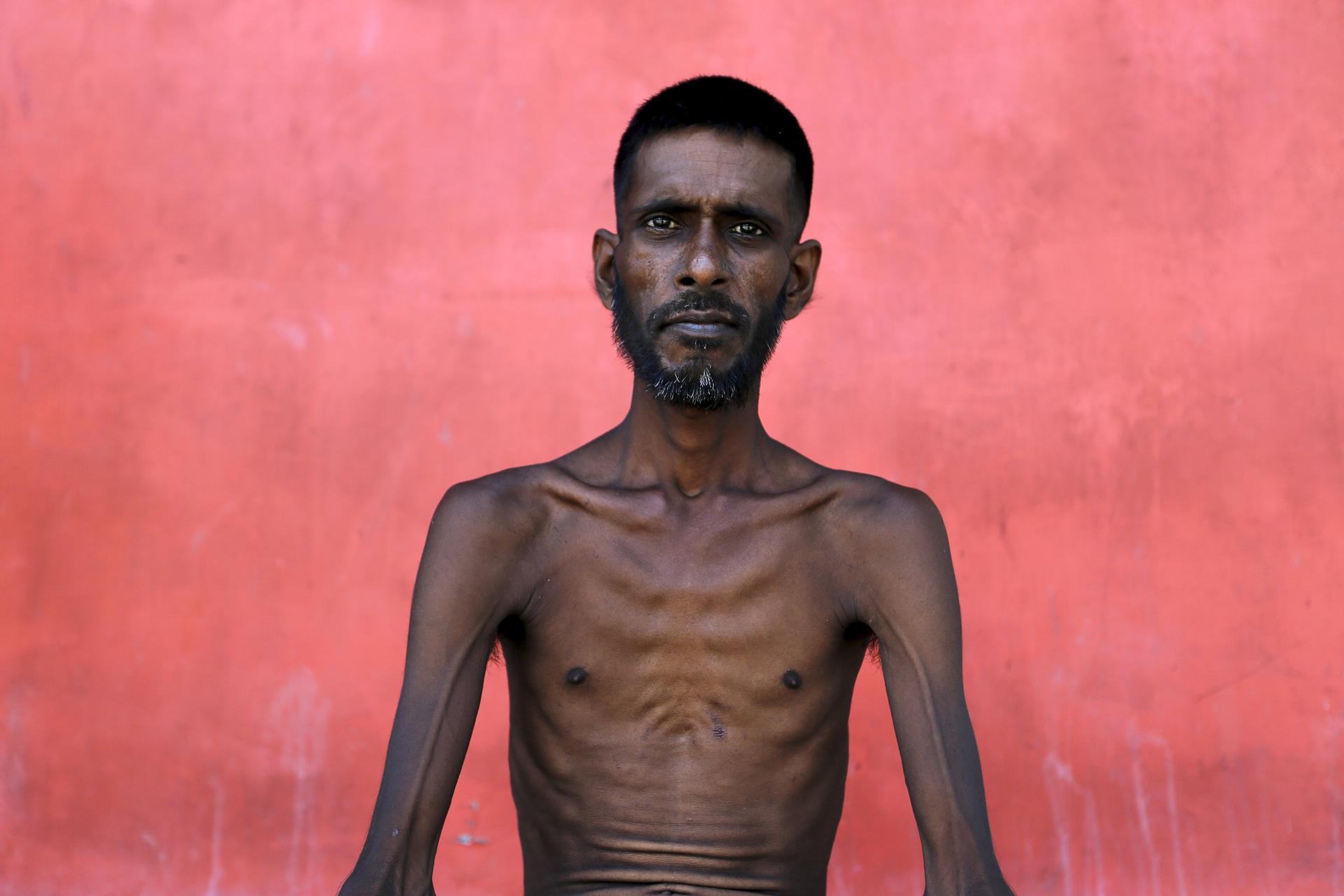 One of the ‘boat people.’ A Bangladeshi migrant allowed into Indonesia after weeks at sea.