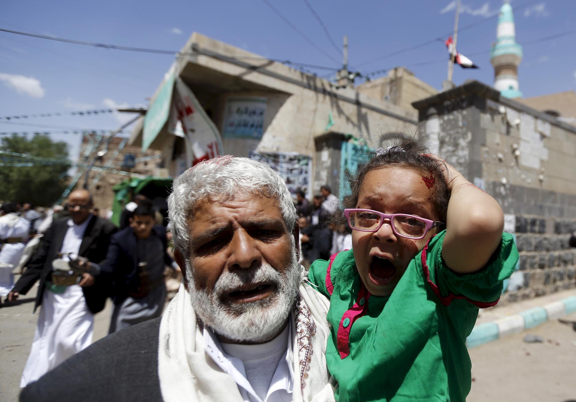 An injured girl reacts as she is carried by a man out of a mosque which was attacked by a suicide bomber in Sanaa on March 20, 2015.