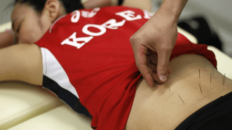 South Korea's women's national volleyball player Lee Sook-ja undergoes an acupuncture session with Park Ji-hun, the oriental doctor in charge of the team, at a gym in Jincheon, 150 km south of Seoul, July 5, 2012.
