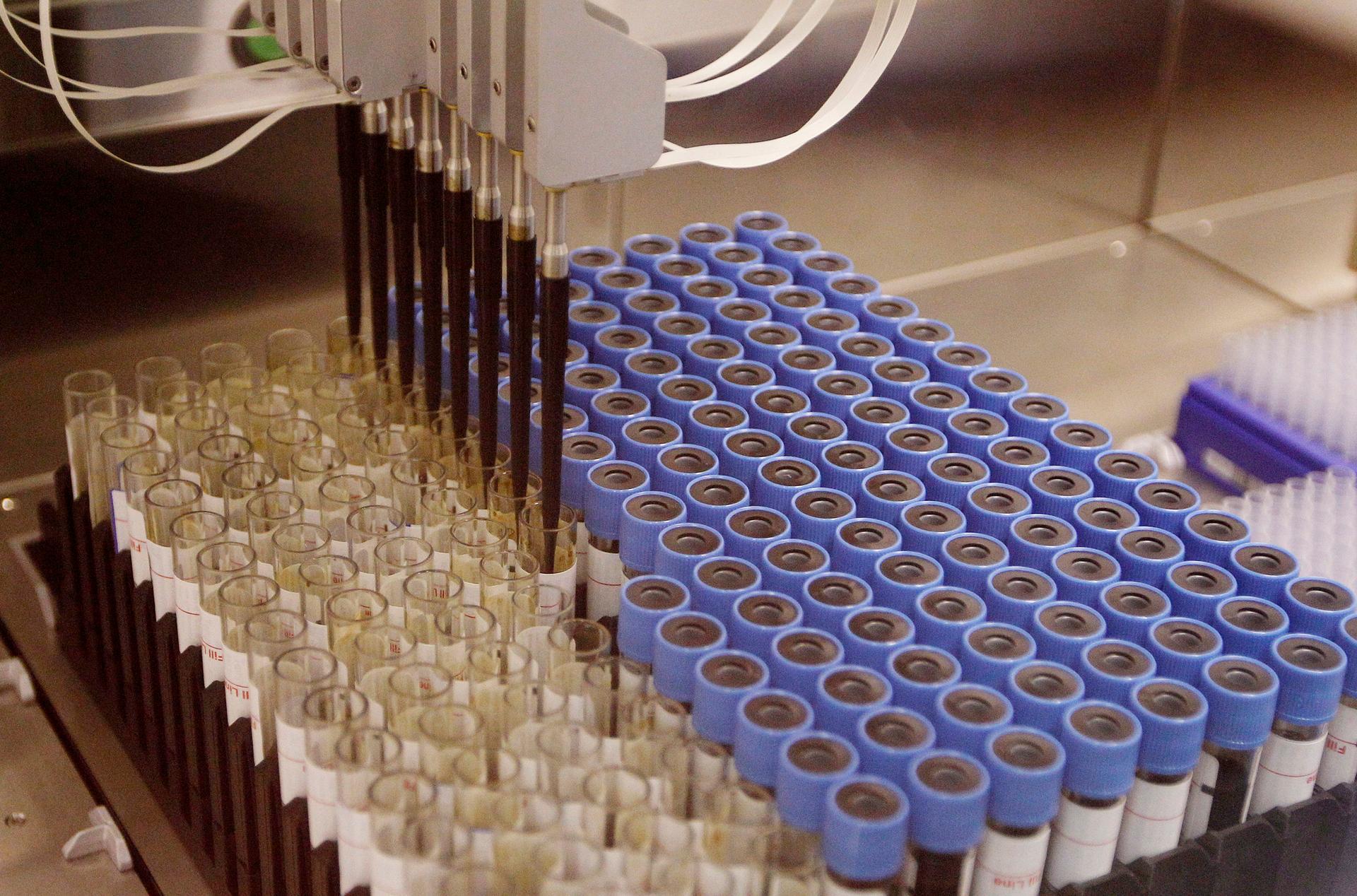 Blood samples are processed at Biobank