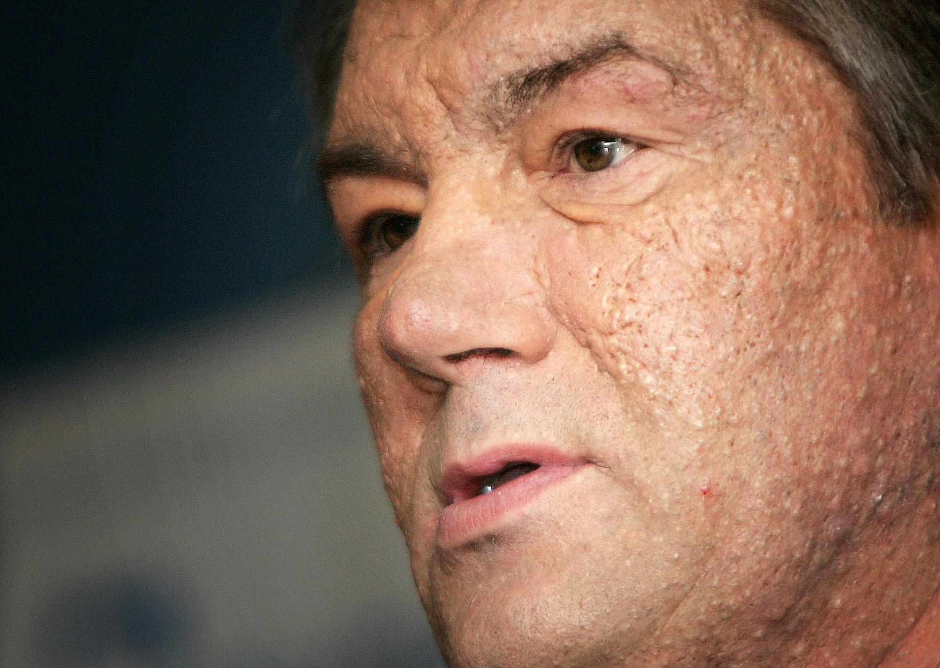 Ukrainian President Viktor Yushchenko
