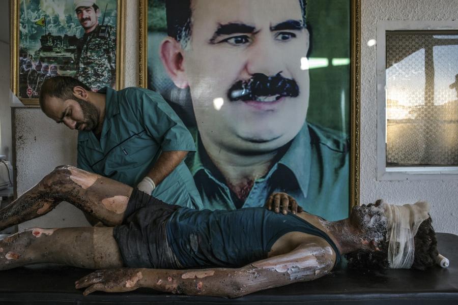A doctor rubs ointment on the burns of a 16-year-old Islamic State fighter named Jacob in front of a poster of Abdullah Ocalan, the jailed leader of the Kurdistan Workers' Party, at a Y.P.G. hospital compound on the outskirts of Hasaka, Syria.