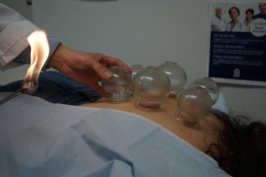A patient lies on an exam room table at the Metta Health Center, receiving cupping therapy. Cupping is a centuries old treatment, in which flame-heated glass cups are attached to your back, and then popped off leaving red round circles. 