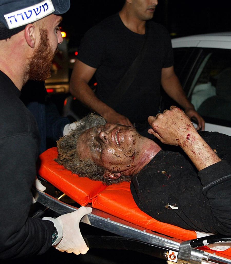 A wounded Jack Baxter is evacuated to an ambulance on April 30, 2003, after a suicide bomber blew himself up at the doorway of a beachfront bar called 'Mike's Place'. The bombing took place just a short distance from the local US embassy.