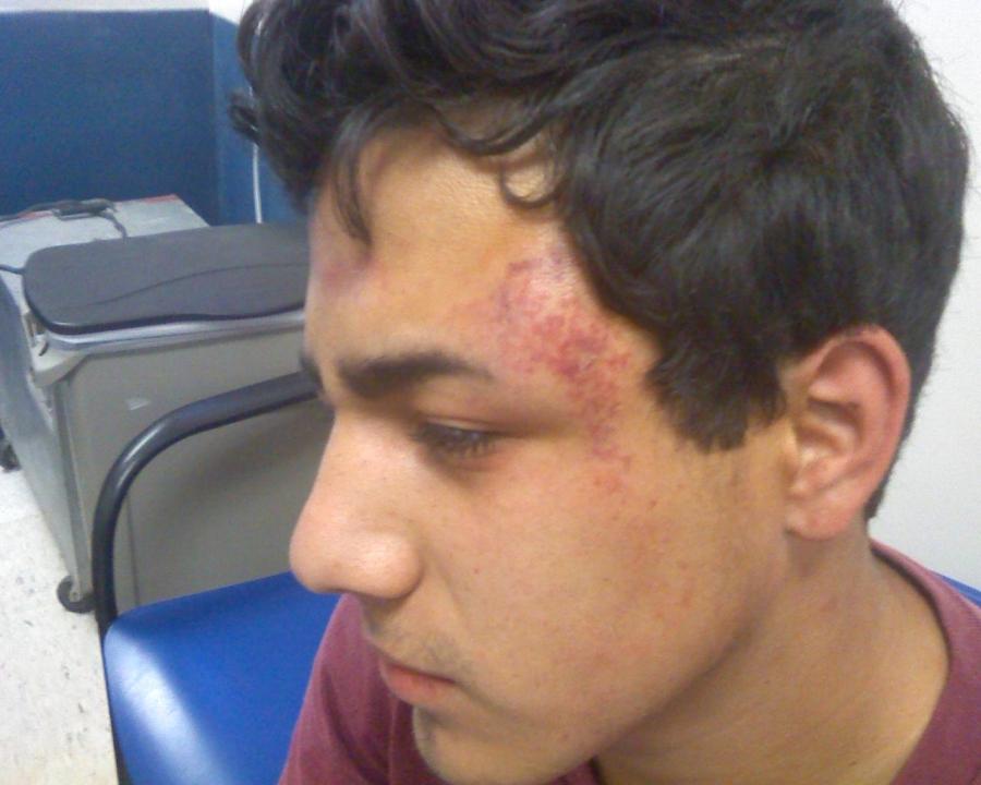 Josue “Josh” Muniz was left with bruises, scrapes and burns from pepper spray after a San Bernardino, Calif. school police officer subdued him following a dispute that started with Josue hugging his girlfriend at lunch. 