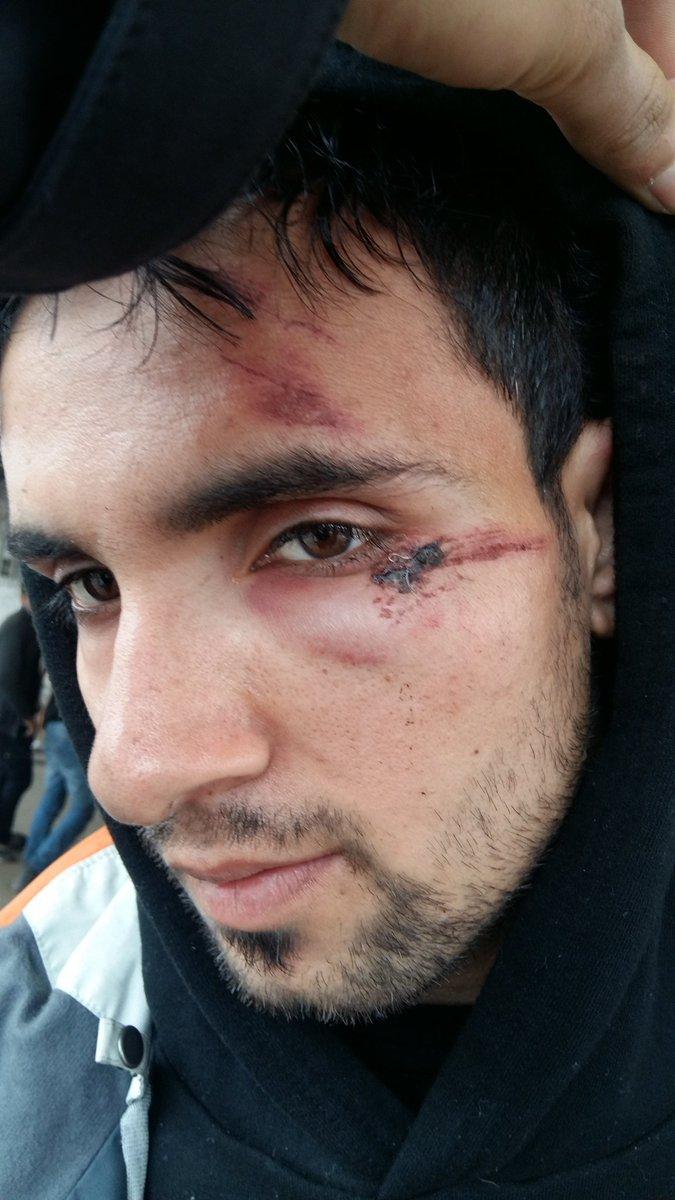 An Afghan asylum-seeker provided images of what he said were injuries other migrants sustained from Hungarian authorities.