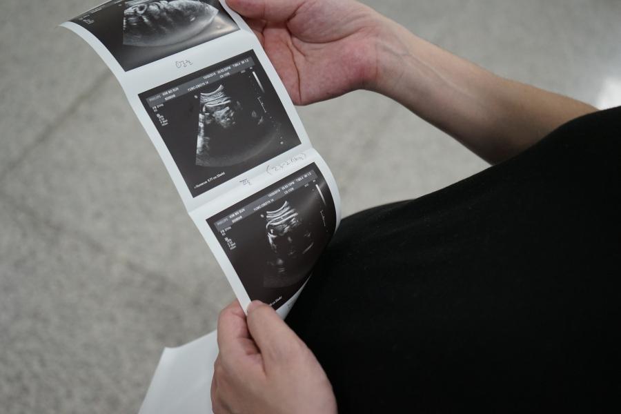 A woman holds her ultrasound pictures