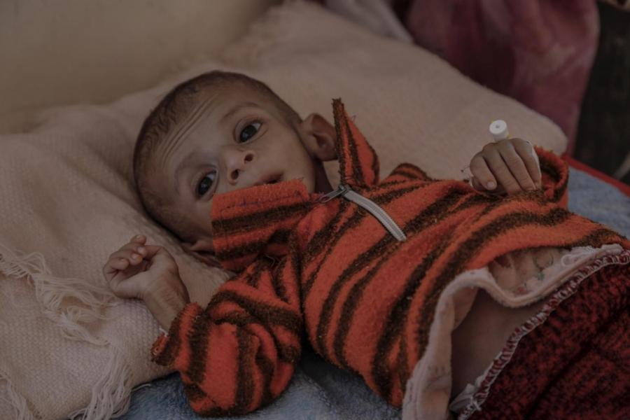 According to the head of pediatrics, cases of malnutrition in al-Gomhouri hospital in Saada have risen by 400 percent since the start of the conflict.