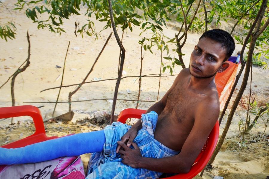 Mohammed Alam, 25, was injured when an elephant attacked the tent where he and his family were sleeping on the edges of Kutupalong refugee camp, which houses hundreds of thousands of Rohingya refugees from Myanmar. Alam's wife, father and son were all kil