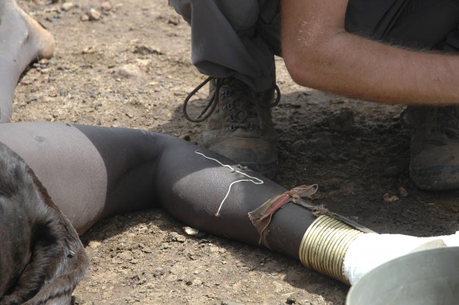 A guinea worm emerges from the leg of a South Sudanese girl in Juba in this picture taken in 2007. After living inside its host for up to 14 months, the long Guinea worm, a spaghetti-like waterborne parasite up to three feet long, releases chemicals to so