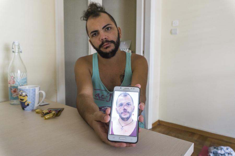 Lawrence Alatrash shows a photo of himself brutally beaten, which he took with his mobile phone after he was attacked and raped by three other Syrian refugees in downtown Athens, Greece.